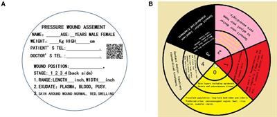 A wound evaluation tool to prevent pressure ulcers